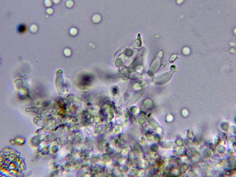 Costantinella micheneri 10 - Conidióforos agua ampliación